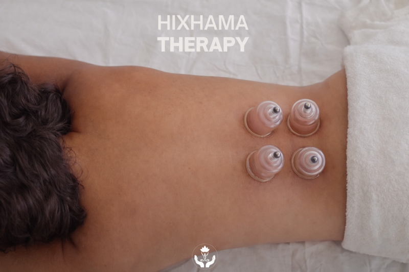 Hixhama, hixhama Tirana, hixhama therapy, hijama therapy, hijama Tirana,...